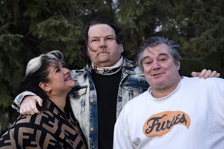 Man gets face, hands in rare surgery